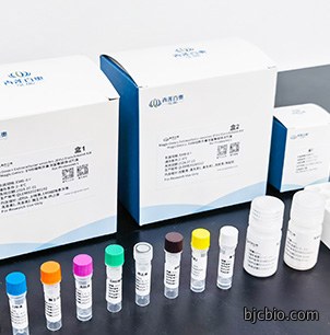 细胞外囊泡纯化试剂盒MagicOmicsEMC